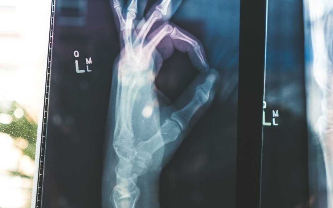 Medical X-ray with a hand doing the OK sign