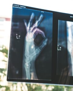 Medical X-ray with a hand doing the OK sign
